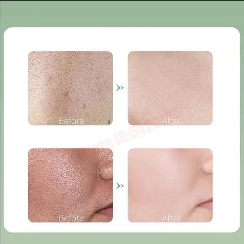 Deep Cleansing Hydrating Bubble Mask with Centella Asiatica for Blackhead Removal and Purification